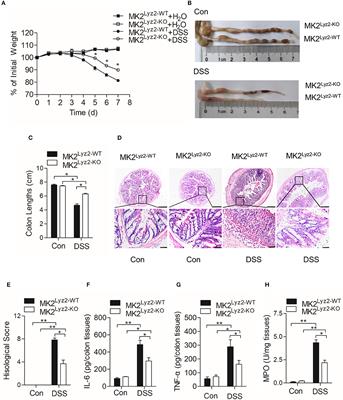 MK2 Is Required for Neutrophil-Derived ROS Production and Inflammatory Bowel Disease